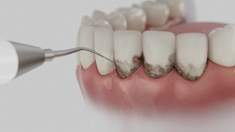Reliable Dental contractor in Winchester, IN by Dentist Open Now